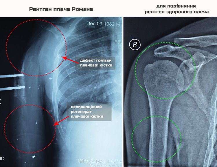 rengen dqxikeidqxidqeant