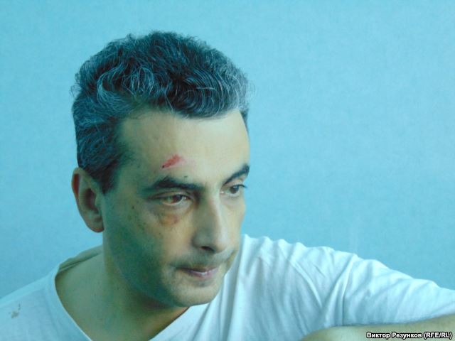 Лев Шлосберг в больнице