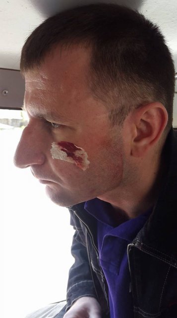 В Тернополе избили журналистов прямо во время расследования - 120853 В Тернополе избили журналистов прямо во время расследования - фото 120853 dqxikeidqxidqeant