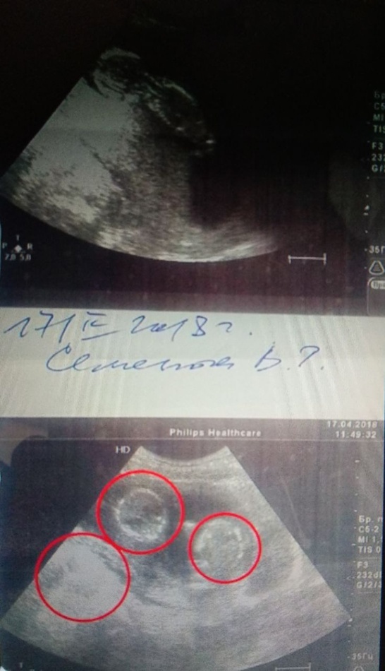 ÑодÑ, деÑи, ÑÑойнÑ, пÑеÑÑÑпление, dqxikeidqxidqeant