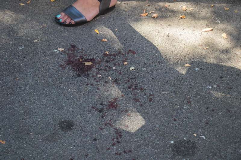 ÐÐ¼Ñ Ð¾ÑоÑвало киÑÑÑ ÑÑки мÑÑоÑовозом