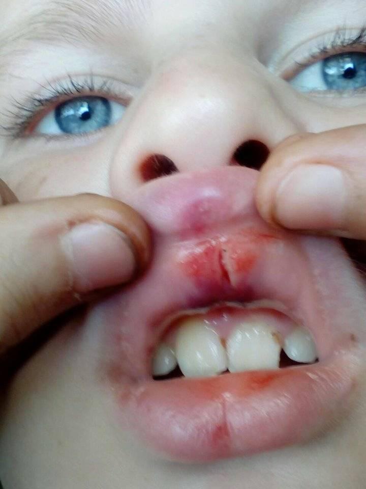 На Прикарпатье ребенка погибшего АТОшника избили за казачий чуб dqxikeidqxidqeant