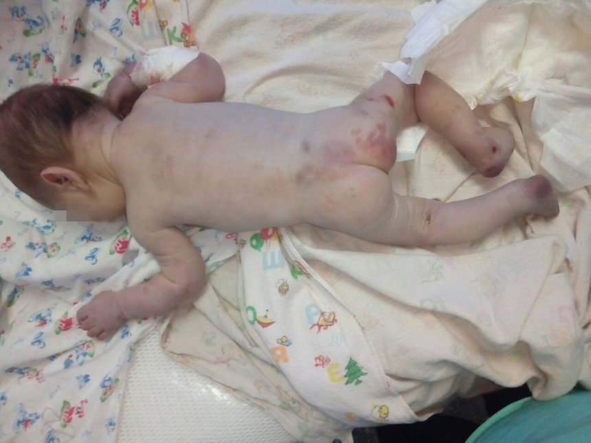 Состояние тяжелое: всплыли новые детали ’’избиения’’ младенца на Николаевщине dqxikeidqxidqeant