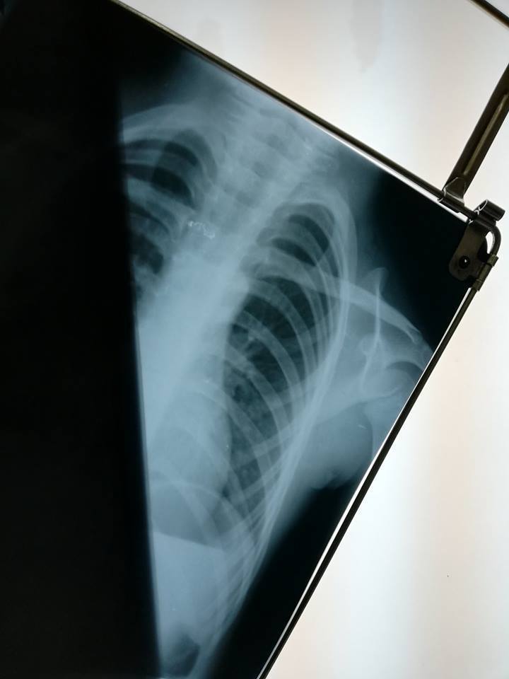    :         dqxikeidqxidqrant