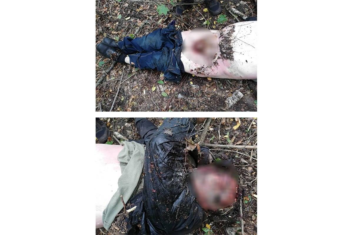 РполиÑии опÑовеÑгли инÑоÑмаÑÐ¸Ñ Ð¾Ð± оÑÑезанном Ñлене dqxikeidqxidqeant