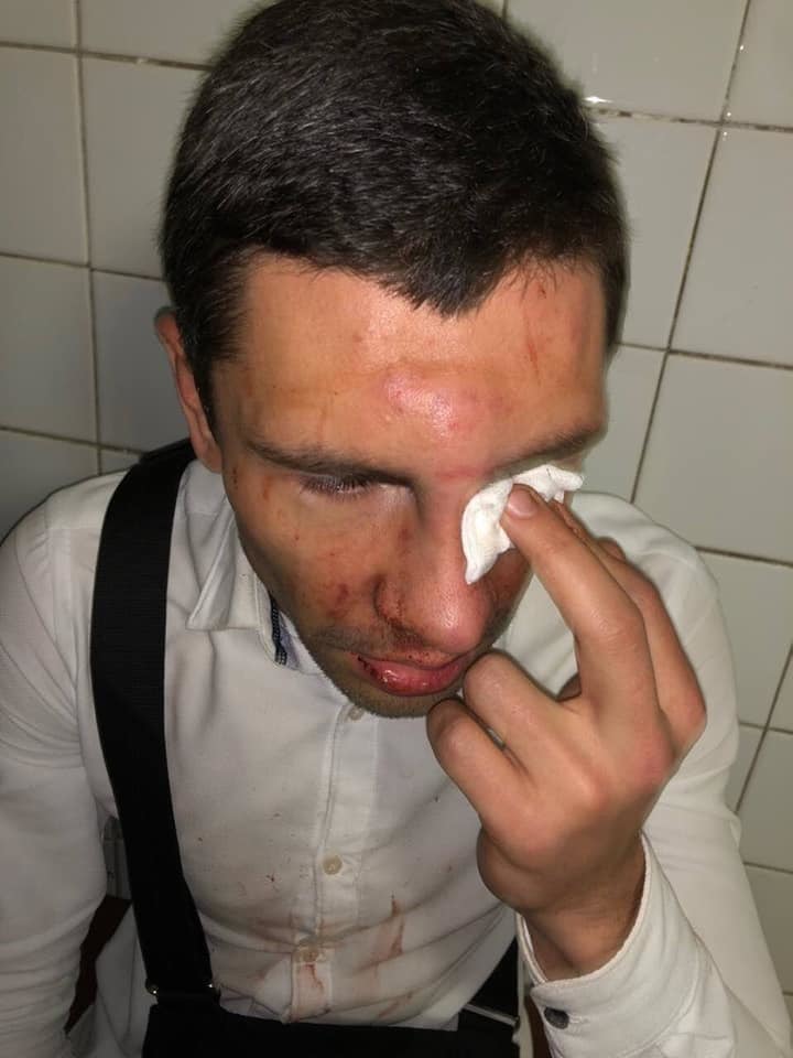 ÃÂŸÃÂ¾Ã‘ÂÃÂ»ÃÂµÃÂ´ÃÂ½ÃÂµÃÂµ ÃÂ¿Ã‘Â€ÃÂµÃÂ´Ã‘ÂƒÃÂ¿Ã‘Â€ÃÂµÃÂ¶ÃÂ´ÃÂµÃÂ½ÃÂ¸ÃÂµ: ÃÂ² ÃÂšÃÂ¸ÃÂµÃÂ²ÃÂµ ÃÂ¶ÃÂµÃ‘ÂÃ‘Â‚ÃÂ¾ÃÂºÃÂ¾ ÃÂ¸ÃÂ·ÃÂ±ÃÂ¸ÃÂ»ÃÂ¸ Ã‘ÂÃÂ¾Ã‘Â€ÃÂ°Ã‘Â‚ÃÂ½ÃÂ¸ÃÂºÃÂ° ÃÂ›Ã‘ÂÃ‘ÂˆÃÂºÃÂ¾ dqxikeidqxiuuant