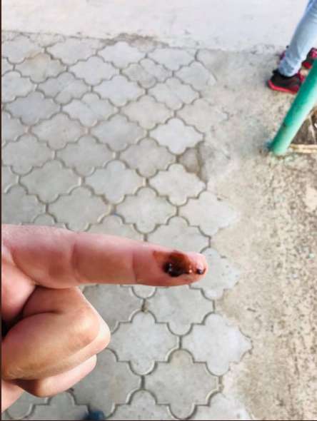 Город-катастрофа: появились новые фото и видео из Армянска