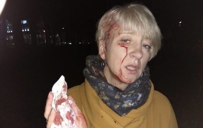 Лариса Гольник