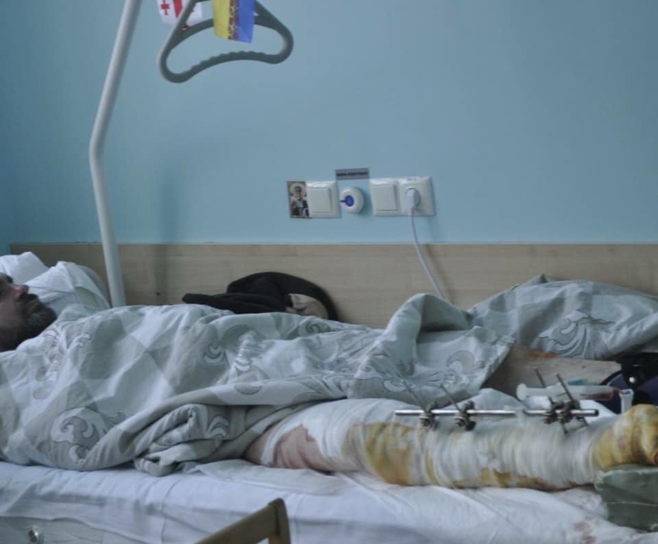   !         dqxikeidqxidqrant