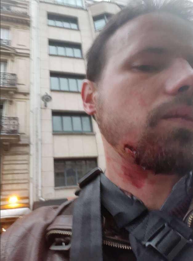 Ð¢Ð¾Ð¿Ð»Ð¸Ð²Ð½Ñ‹Ð¹ ÐœÐ°Ð¹Ð´Ð°Ð½: Ð² ÐŸÐ°Ñ€Ð¸Ð¶Ðµ Ð¿Ð¾Ð´ÑÑ‚Ñ€ÐµÐ»Ð¸Ð»Ð¸ Ð¿Ñ€Ð¾Ð¿Ð°Ð³Ð°Ð½Ð´Ð¸ÑÑ‚Ð° ÐšÑ€ÐµÐ¼Ð»Ñ dqxikeidqxidqrant