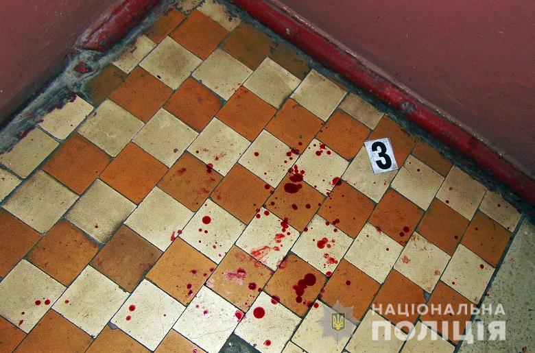 Родном из Ñ
оÑÑелов на ÑлиÑе ÐлмаÑинÑкой мÑжÑина ÑдаÑил в гÑÑÐ´Ñ Ð½Ð¾Ð¶Ð¾Ð¼ поÑÑоÑлÑÑа dqxikeidqxidqeant