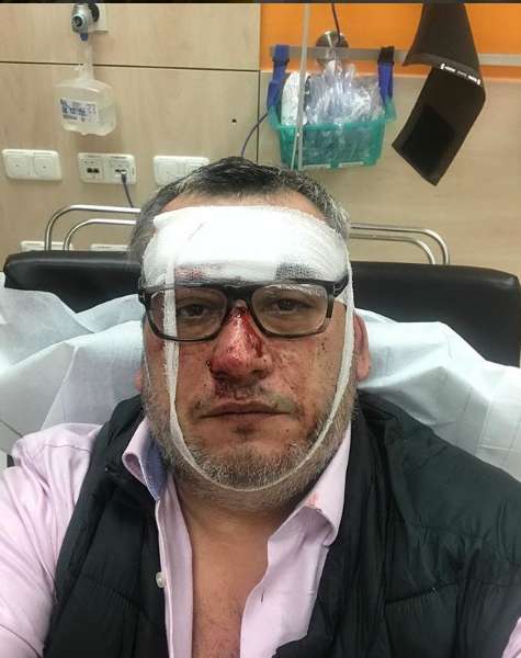 Ð¢Ð°Ðº ÑÐ´ÐµÐ»Ð°ÑŽÑ‚ Ð²Ð¾ Ð²ÑÐµÐ¼ Ð¼Ð¸Ñ€Ðµ: Ñ€Ð¾ÑÑÐ¸Ð¹ÑÐºÐ¾Ð³Ð¾ Ð¿Ñ€Ð¾Ð¿Ð°Ð³Ð°Ð½Ð´Ð¸ÑÑ‚Ð° Ð²Ñ‹ÑˆÐ²Ñ‹Ñ€Ð½ÑƒÐ»Ð¸ Ð¸Ð· Ð±Ð¾Ð»ÑŒÐ½Ð¸Ñ†Ñ‹ Ð² Ð“ÐµÑ€Ð¼Ð°Ð½Ð¸Ð¸  dqxikeidqxidqeant