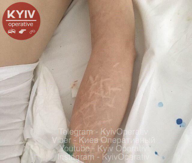 РÑÑ
нÑла Ñ Ð²ÑÑоÑÑ: в Ðиеве наÑли иÑкалеÑеннÑÑ Ð¶ÐµÐ½ÑÐ¸Ð½Ñ Ñ ÑаÑÑиÑовкой