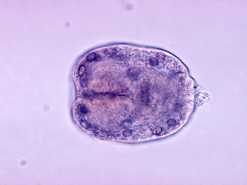 Гистологический препарат Echinococcus granulosus dqxikeidqxidqrant
