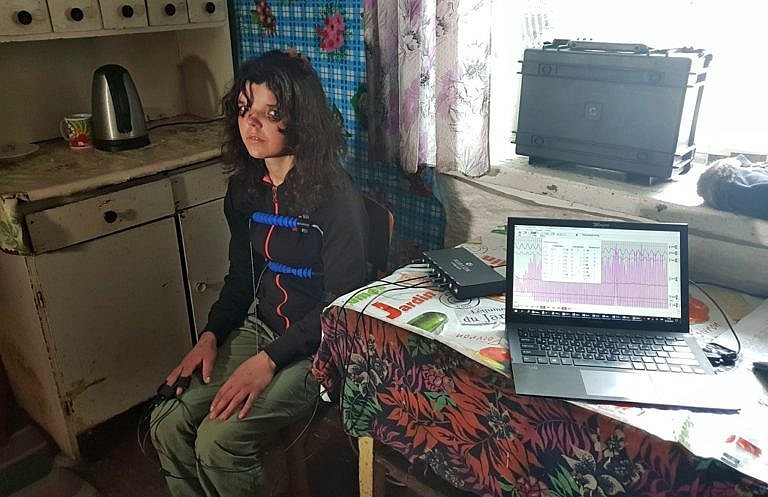 Мачеха побитого ребенка dqxikeidqxidqeant