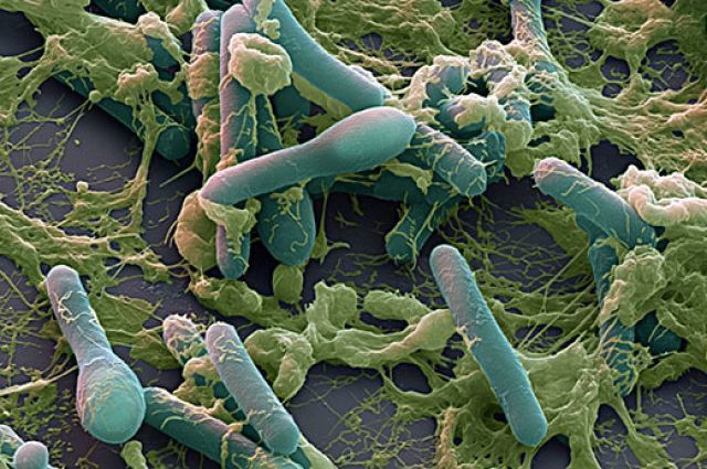 Ботулизм dqxikeidqxiqdzant