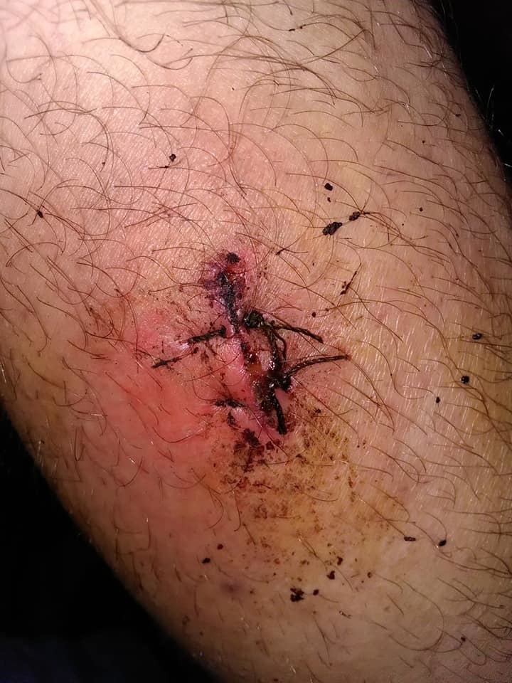 Новая бойня соседей: в многоэтажке Киева с ножом напали на семью dqxikeidqxidqeant