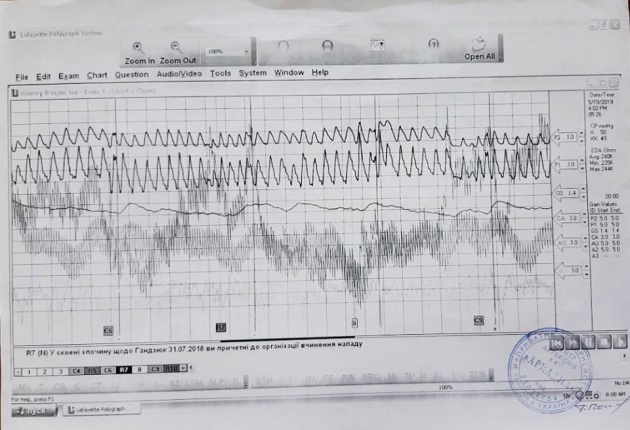 Мангер прошел проверку на детекторе лжи 01 Мангер прошел проверку на детекторе лжи 01 dqxikeidqxidqrant