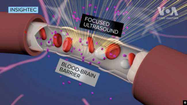 -    dqxikeidqxidqeant