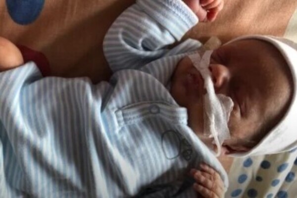 Новорожденный, которому удалили опухоль dqxikeidqxidqeant