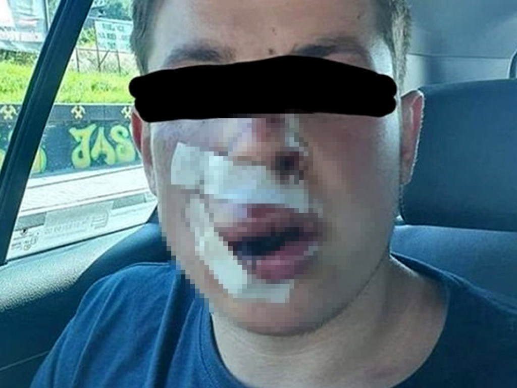 base article image dqxikeidqxidqeant