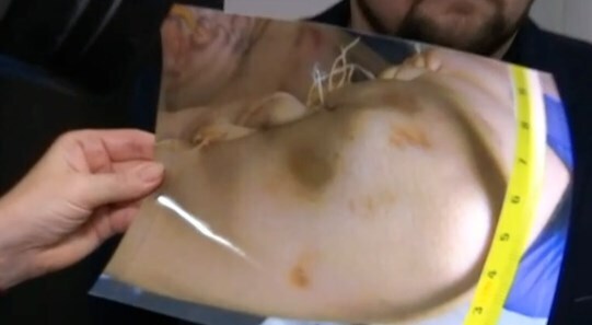 Родители привели доказательства убийства 14-летнего подростка из Прилук dqxikeidqxidqeant