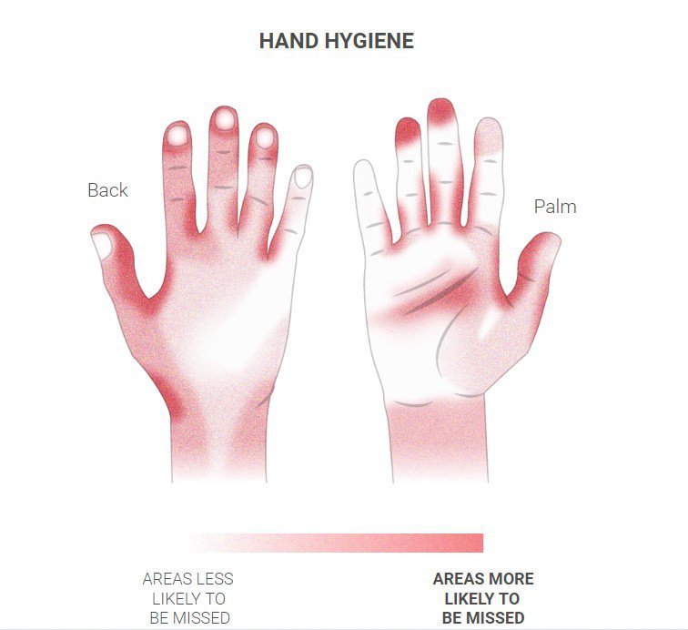 Чим червоніший колір на інфографіці – тим більша ймовірність пропустити цю частину рук при митті dqxikeidqxidqeant