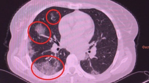 ,   dqxikeidqxidqrant