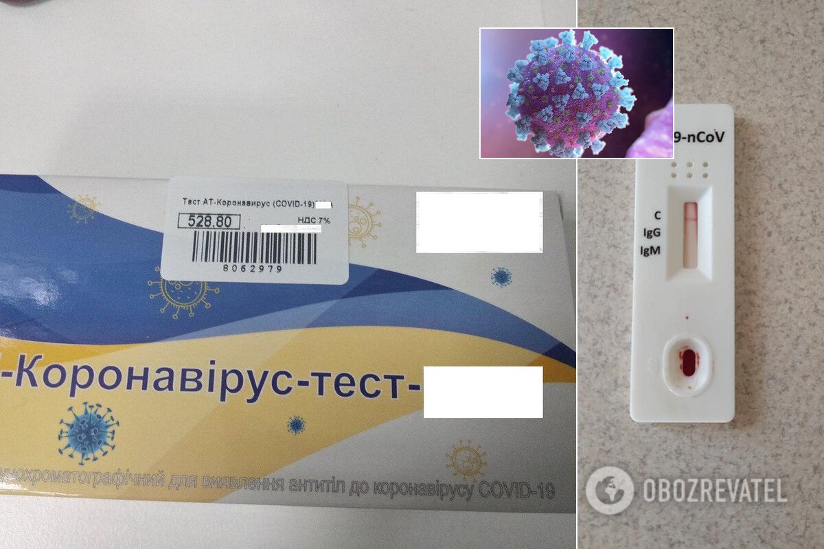 Украинские аптеки заполонили экспресс-тесты на COVID-19: почему это – деньги на ветер dqxikeidqxidqrant