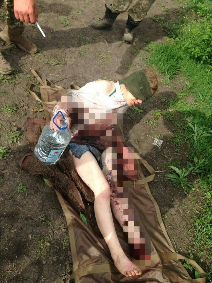 Женщина подорвалась на мине при переходе линии фронта dqxikeidqxidqeant