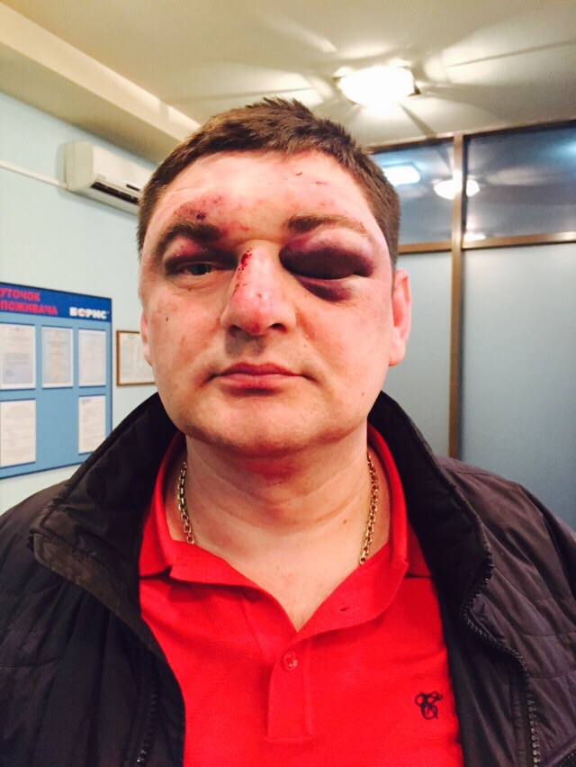 ^FC64A31E193F92C97315BA5DA4CA9944155EB20166B57EF2E5^pimgpsh_fullsize_distr dqxikeidqxidqeant