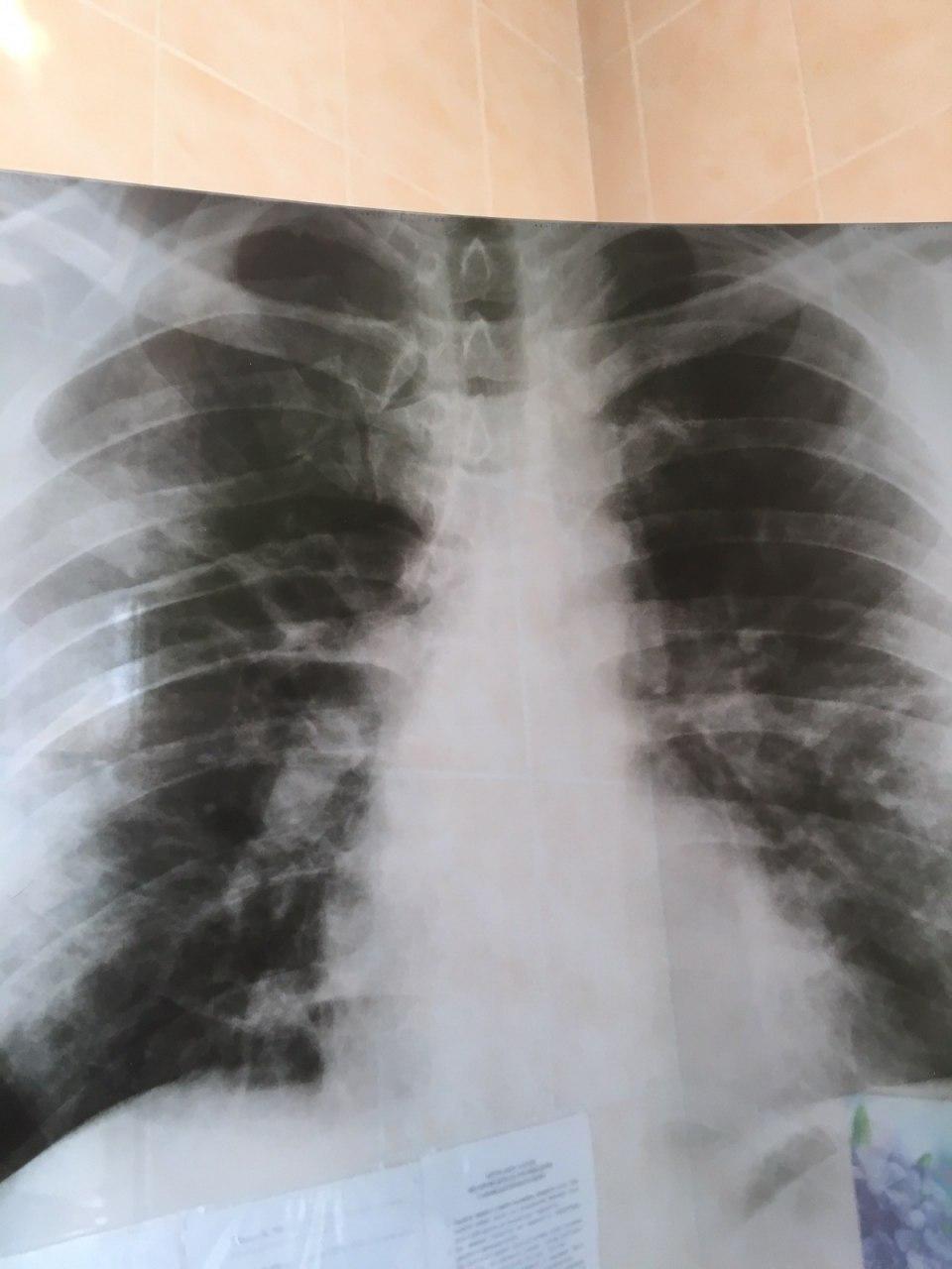  ,    COVID-19 dqxikeidqxidqeant