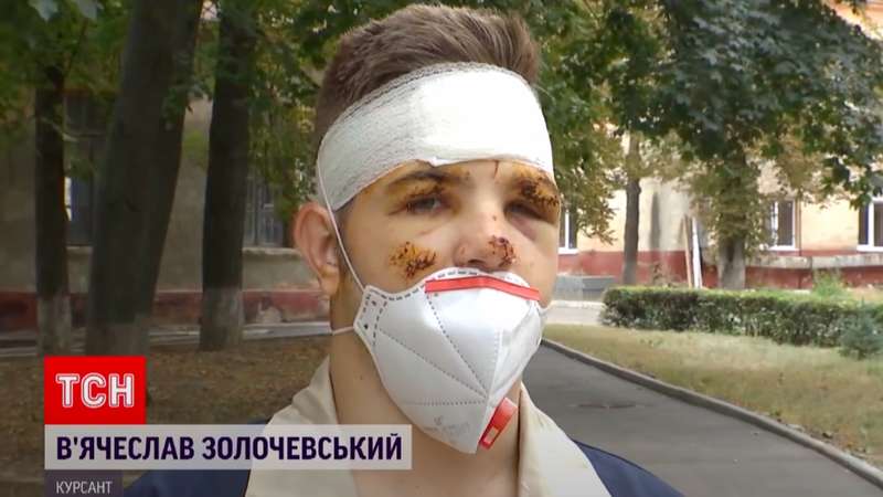 У Вячеслава врачи диагностировали сотрясение головного мозга, ушибы и ожоги. dqxikeidqxidqrant