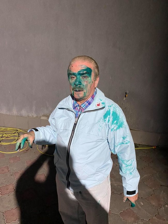 В Тернополе облили зеленкой кандидата на должность мэра от партии Ляшко Барну 02 В Тернополе облили зеленкой кандидата на должность мэра от партии Ляшко Барну 02 dqxikeidqxidqrant