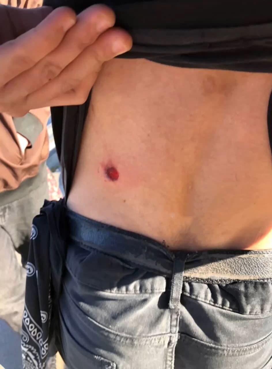 Подростка ранили в левую часть спины dqxikeidqxidqeant