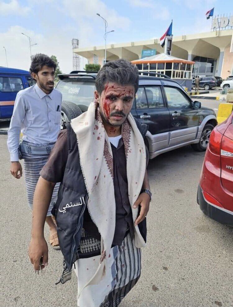 Пострадавшие при взрыве