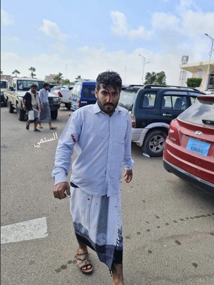 Пострадавшие при взрыве в аэропорту