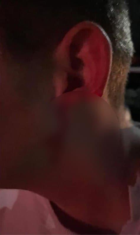 На дискотеке под Ужгородом парню откусили ухо. Фото: Фейсбук dqxikeidqxidqrant