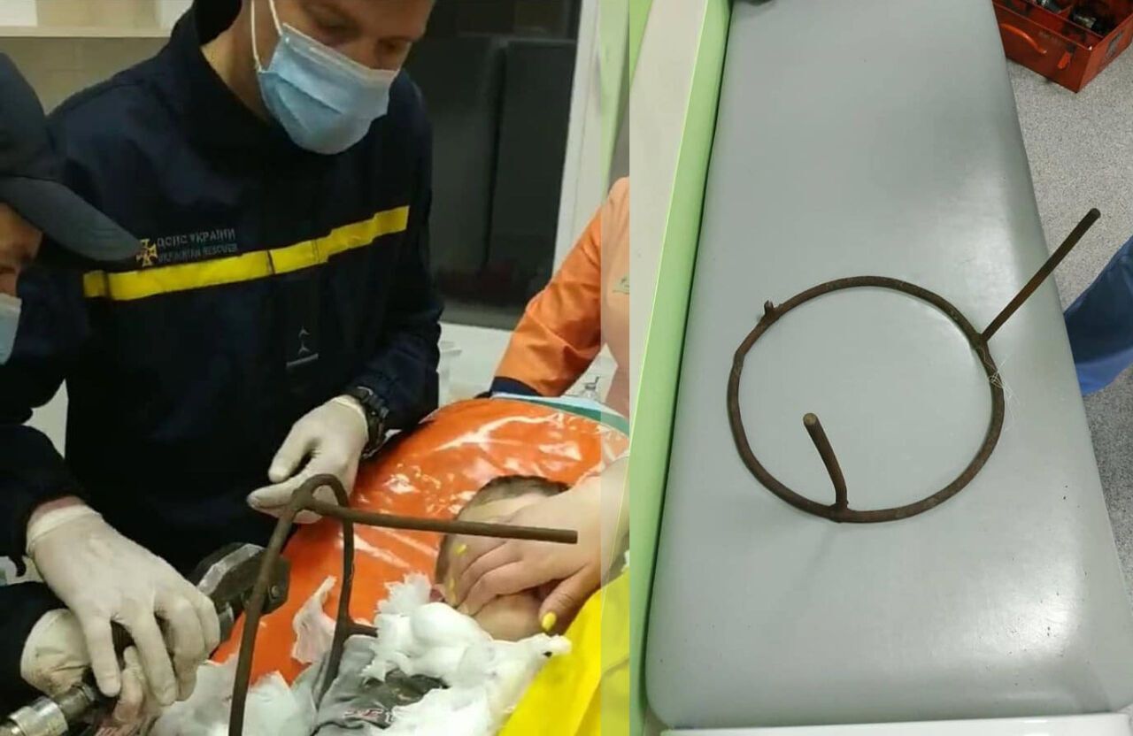 В Полтаве ребенок проткнул шею металлическим стулом dqxikeidqxidqrant