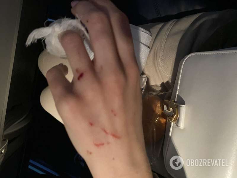 У Юлии были поцарапаны руки и лицо