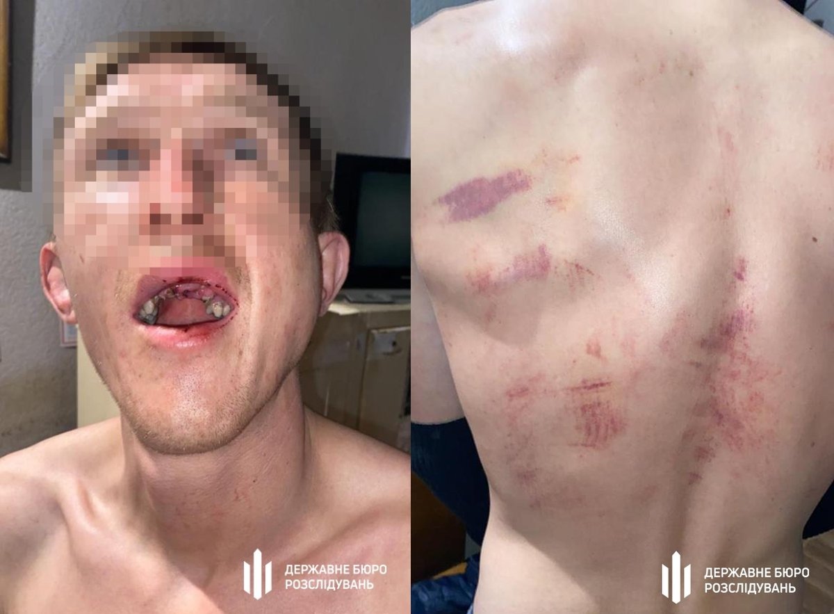         -  1 dqxikeidqxidqrant