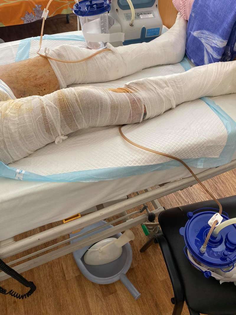 Также на теле воина множество осколочных ранений.