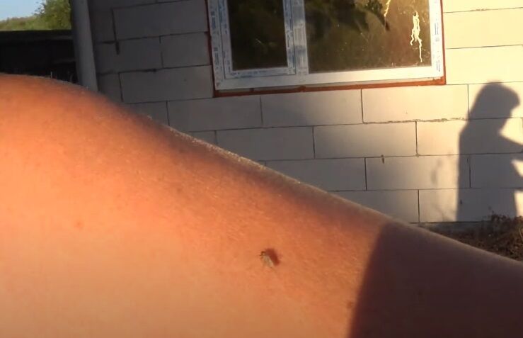 Комары кусают даже днем. dqxikeidqxidqeant