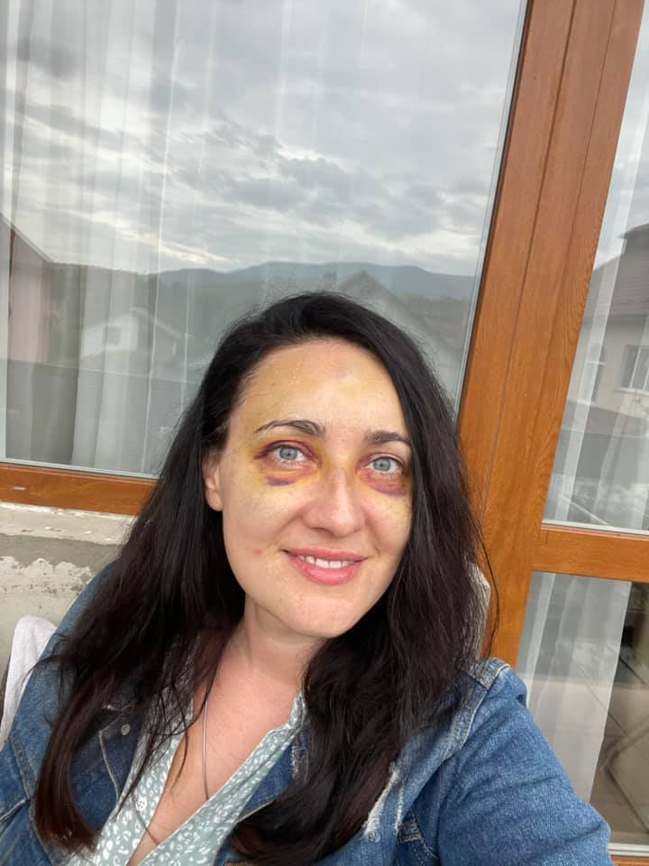 Так выглядит Витвицкая. dqxikeidqxidqrant