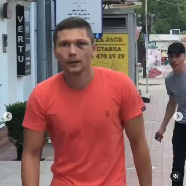 Танцора Нади Дорофеевой жестоко избили dqxikeidqxidqeant