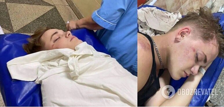 Танцор Евгений Гончаренко после избиения