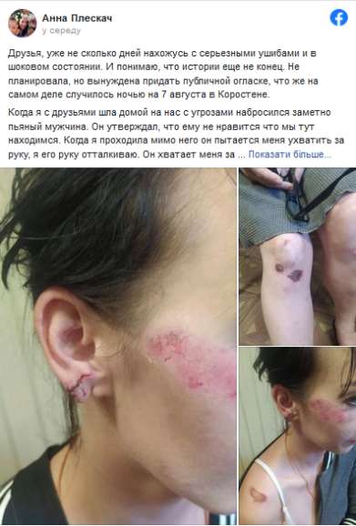 Депутата-"слугу" обвиняют в нападении на женщину 1 8ae26cba2f9f7f872b7d51e04dcf0195 dqxikeidqxitkant