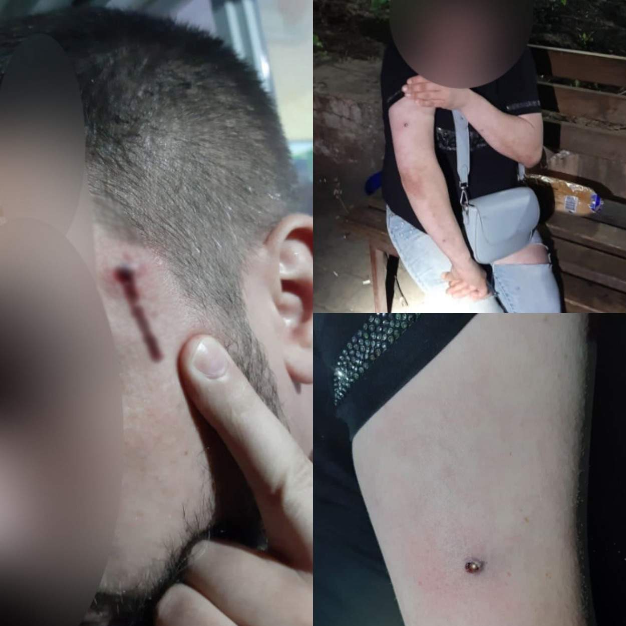 У Дніпрі невідомі стріляли в людей dqxikeidqxidqeant