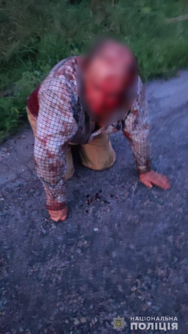 Мужчине пришлось ползти к дороге. dqxikeidqxidqeant