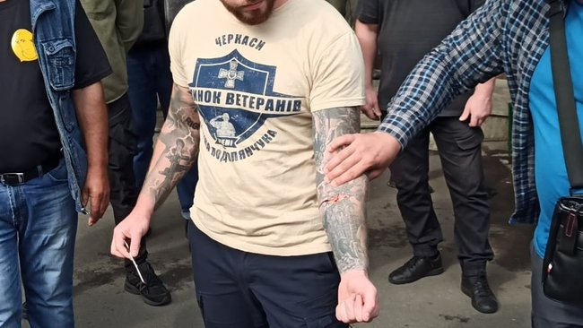 Член Нацкорпуса Кухарчук, которому вручили подозрение за акцию под ОП, порезал себе вены в знак протеста против преследования ветеранов 01 Член Нацкорпуса Кухарчук, которому вручили подозрение за акцию под ОП, порезал себе вены в знак протеста против преследования ветеранов 01 dqxikeidqxidqrant